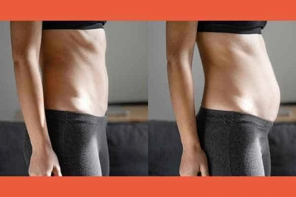 LA-EMS Body Sculpting results Streatham Hill
